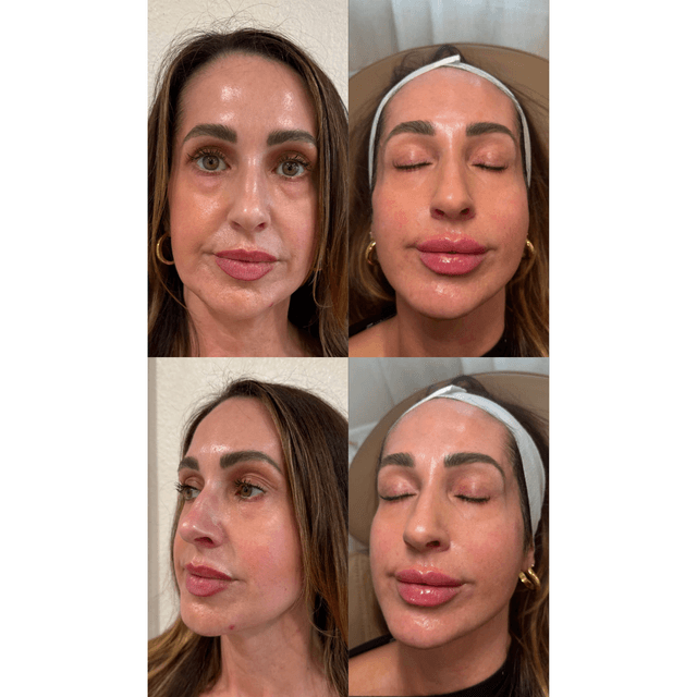 before and after glowing skin